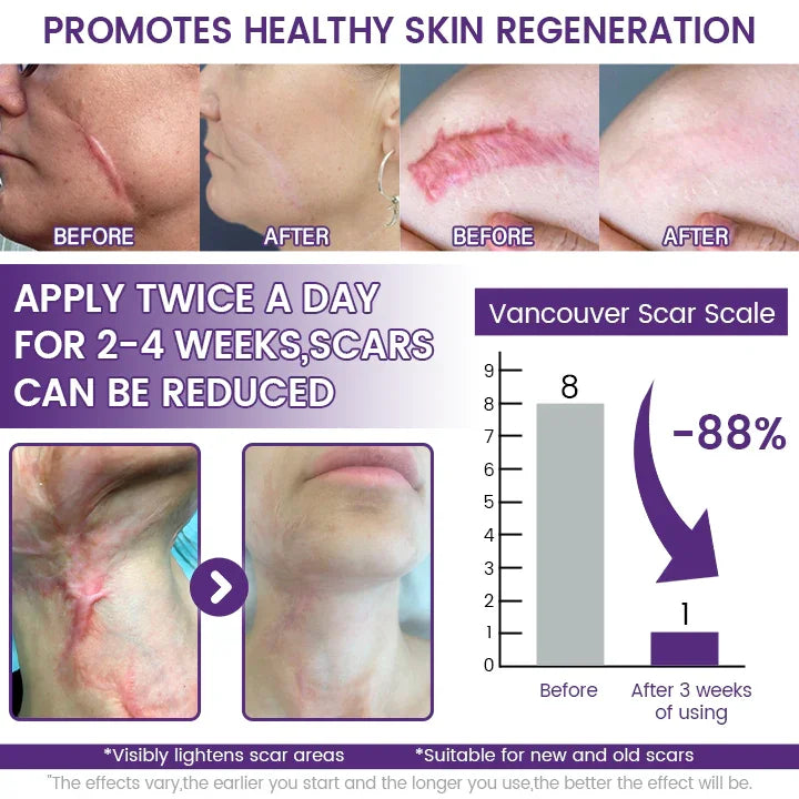 TopSpire® ReGenScar Stem Cell Scar Gel