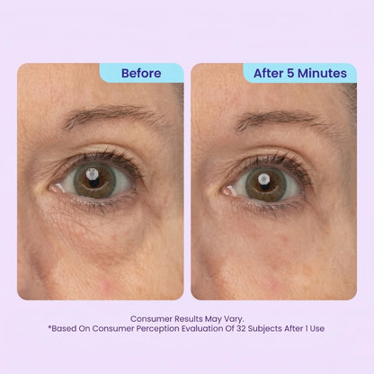 TopSpire™ Instant Lift Eye Gel | For Puffiness & Bags, Wrinkles, Fine Lines and Dark Circles
