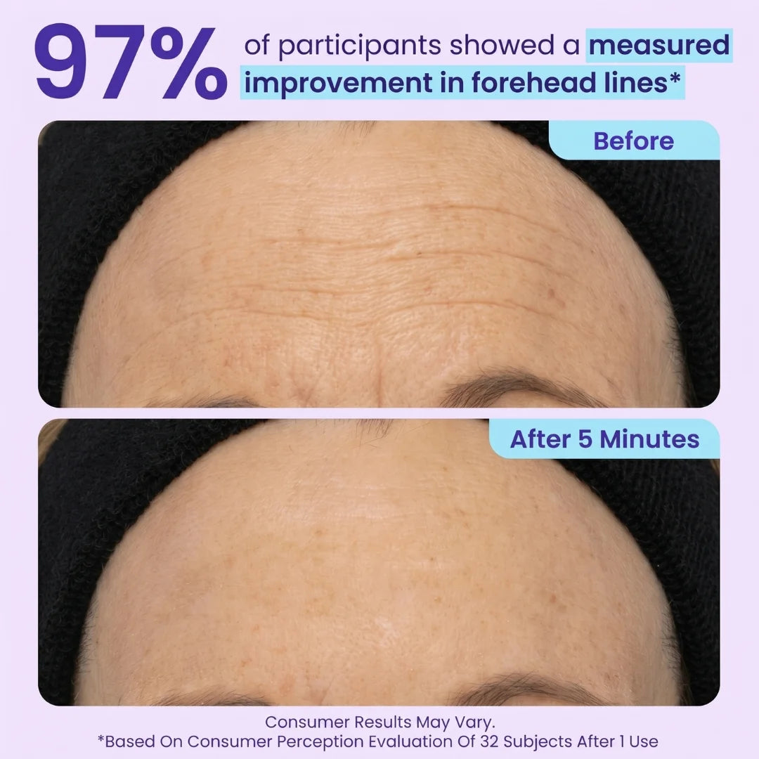 TopSpire™ Instant Lift Eye Gel | For Puffiness & Bags, Wrinkles, Fine Lines and Dark Circles