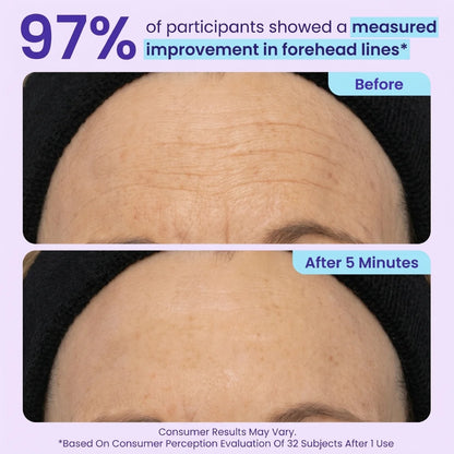 TopSpire™ Instant Lift Eye Gel | For Puffiness & Bags, Wrinkles, Fine Lines and Dark Circles