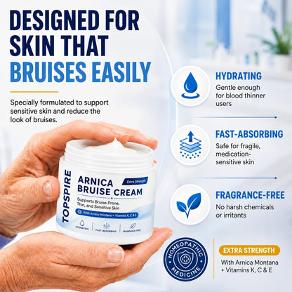 TOPSPIRE® Arnica Bruise Cream💕