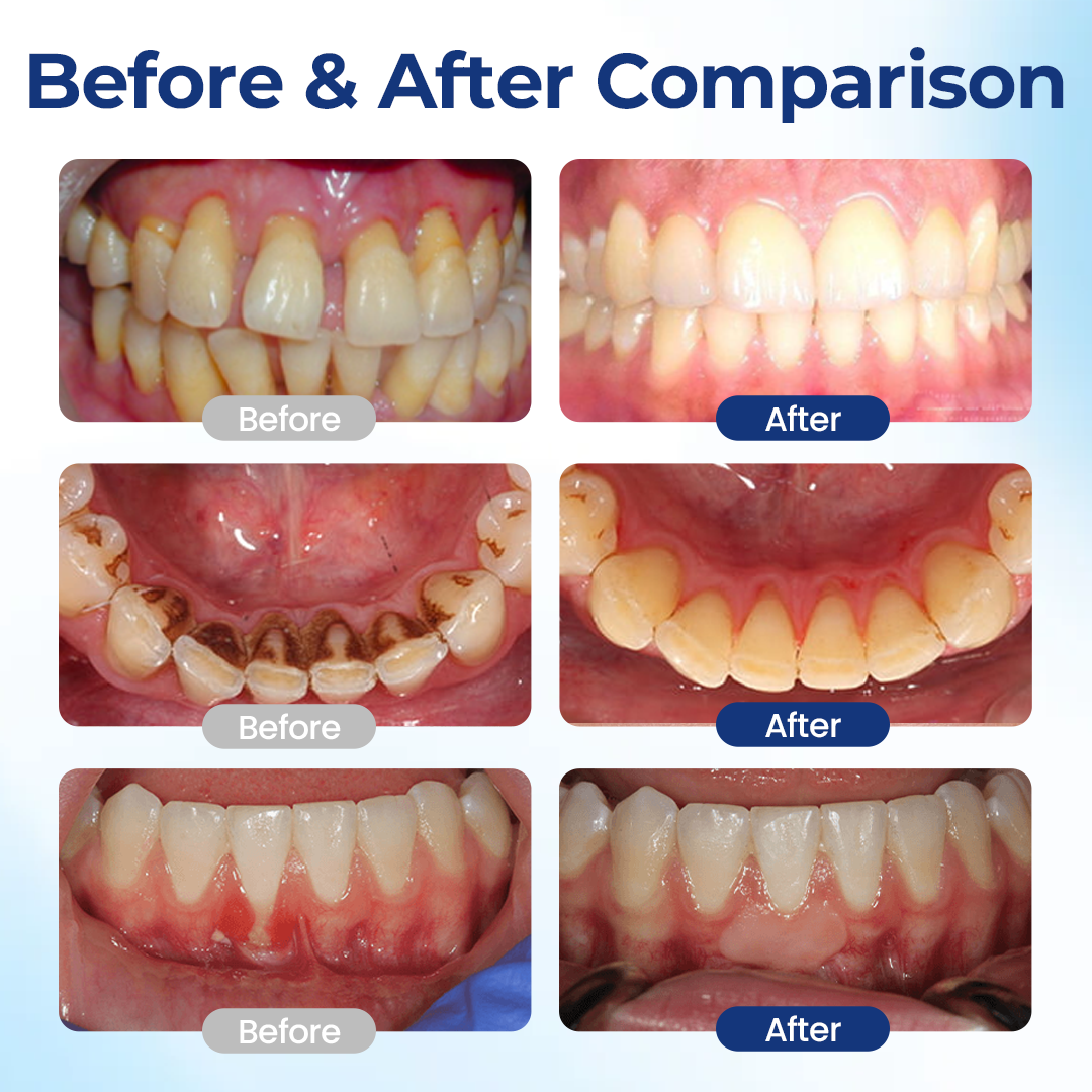TopSpire® BeeTakt Oral Repair Solution