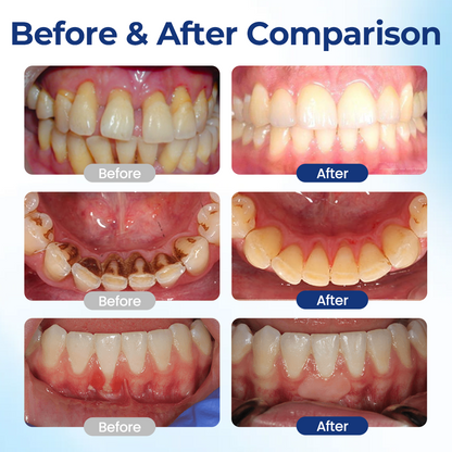 TopSpire® BeeTakt Oral Repair Solution