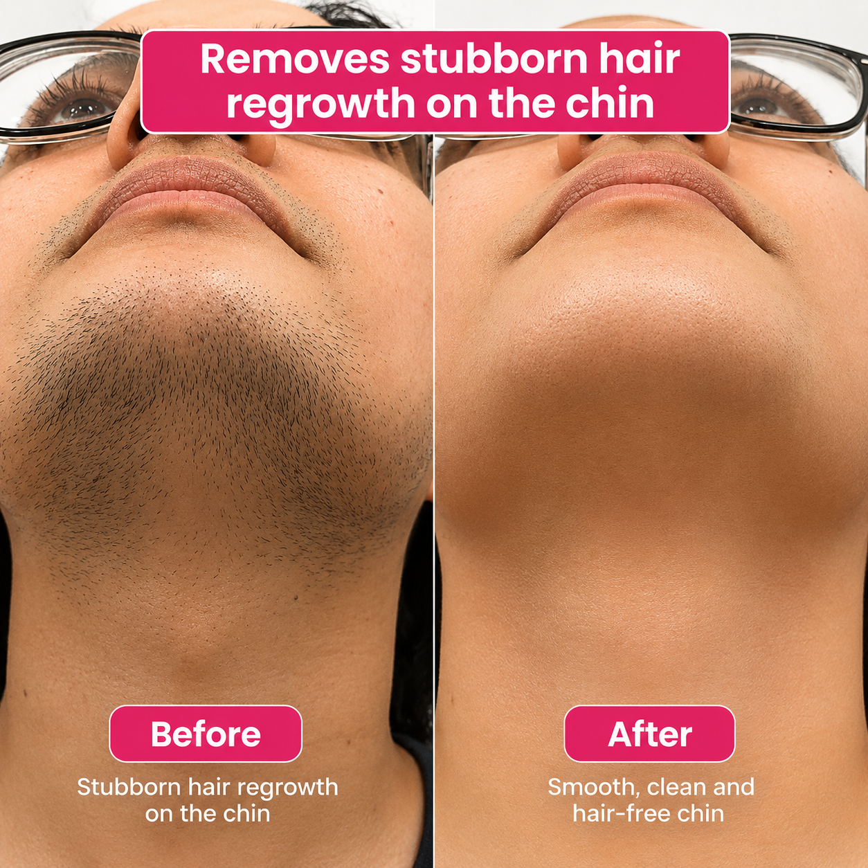 🔥LAST DAY 60% OFF  Soulhera Hair Reduction Oil 60 ml – Permanent Hair Removal Oil