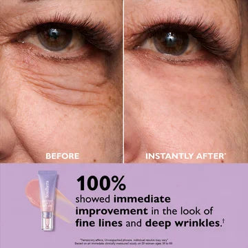 Soulhera Eye Bag Instant Eraser, Tightens, Firms, & Blurs Wrinkles
