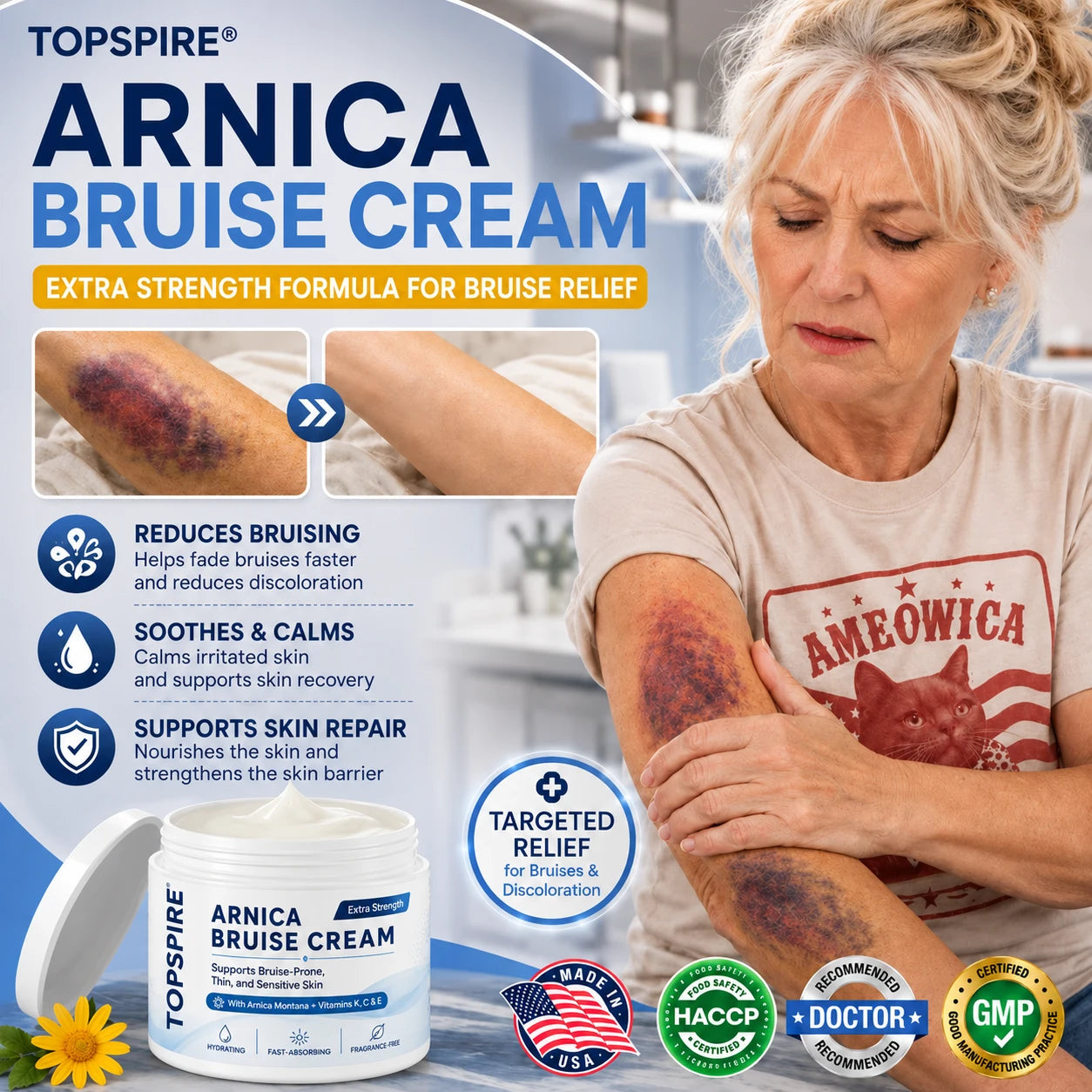 TOPSPIRE® Arnica Bruise Cream💕