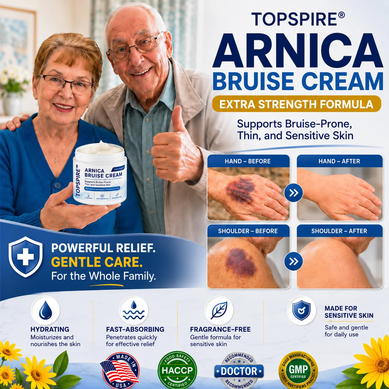 TOPSPIRE® Arnica Bruise Cream💕