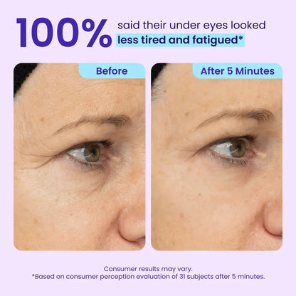 Soulhera Eye Bag Instant Eraser, Tightens, Firms, & Blurs Wrinkles