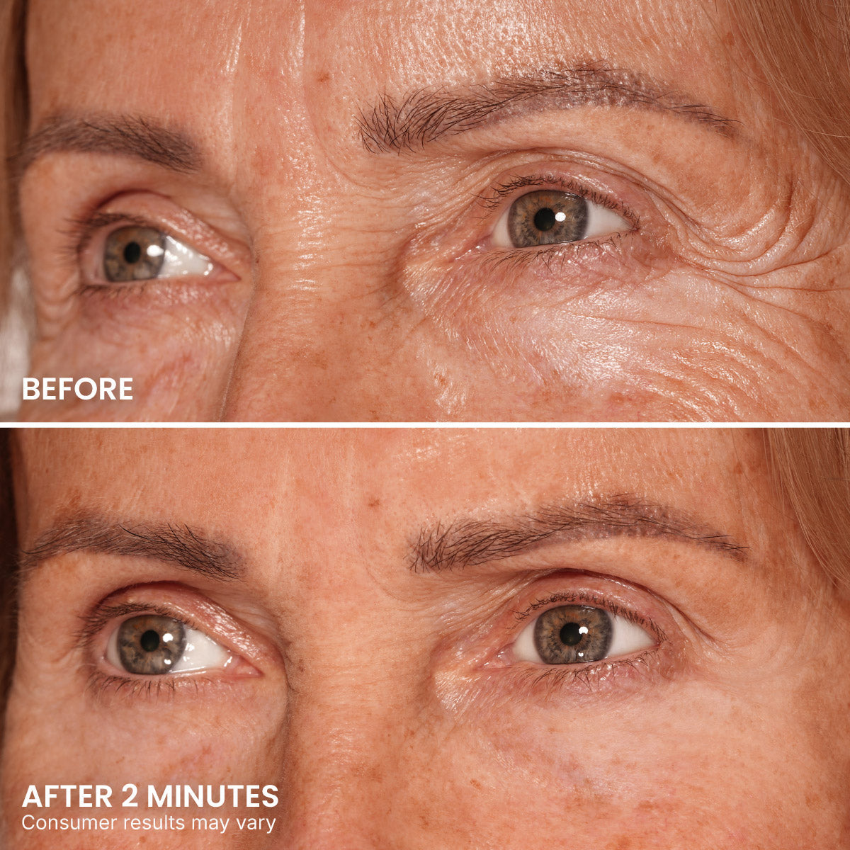 🌸 TopSpire Instant Eye Tightener – New Formula, Ultimate Lift & Smooth Finish ✨