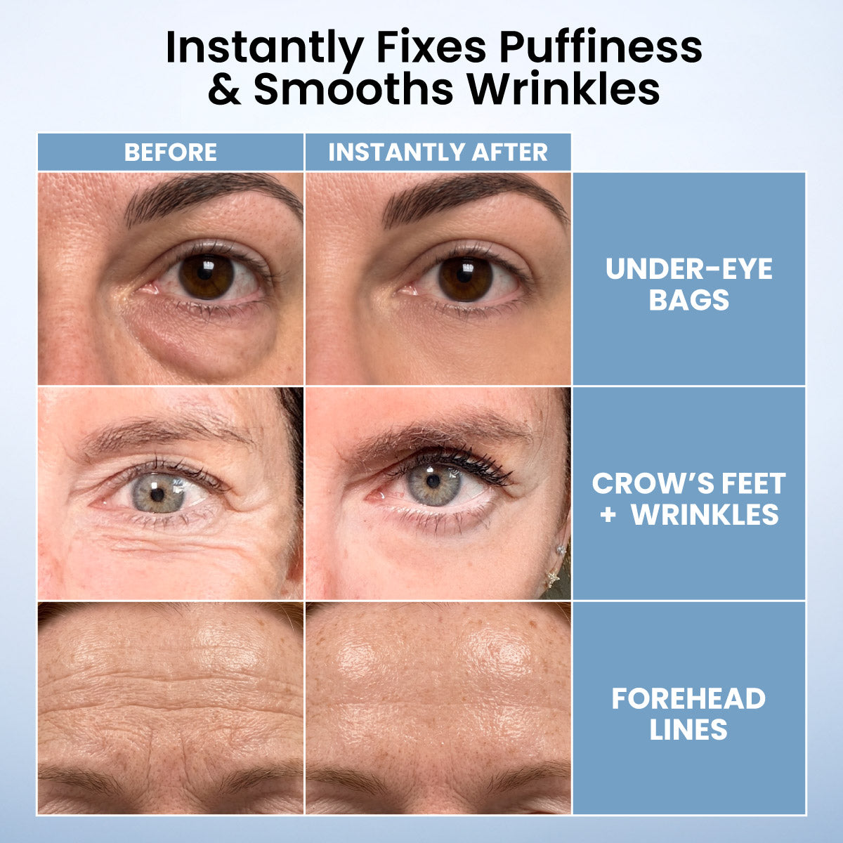 🌸 TopSpire Instant Eye Tightener – New Formula, Ultimate Lift & Smooth Finish ✨