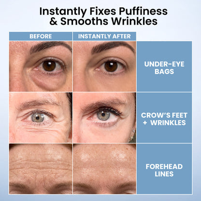 🌸 TopSpire Instant Eye Tightener – New Formula, Ultimate Lift & Smooth Finish ✨