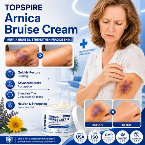 TOPSPIRE® Arnica Bruise Cream💕