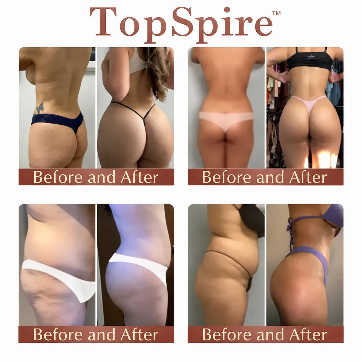 TopSpire™ CurveSculpt Micro-Patch ✦ Sculpt • Firm • Smooth Lower Body Curves ✦ Micro-Needle Infusion System