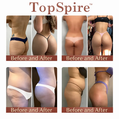 TopSpire™ CurveSculpt Micro-Patch ✦ Sculpt • Firm • Smooth Lower Body Curves ✦ Micro-Needle Infusion System