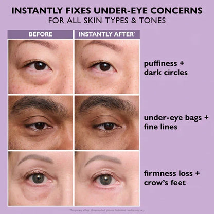 Soulhera Eye Bag Instant Eraser, Tightens, Firms, & Blurs Wrinkles